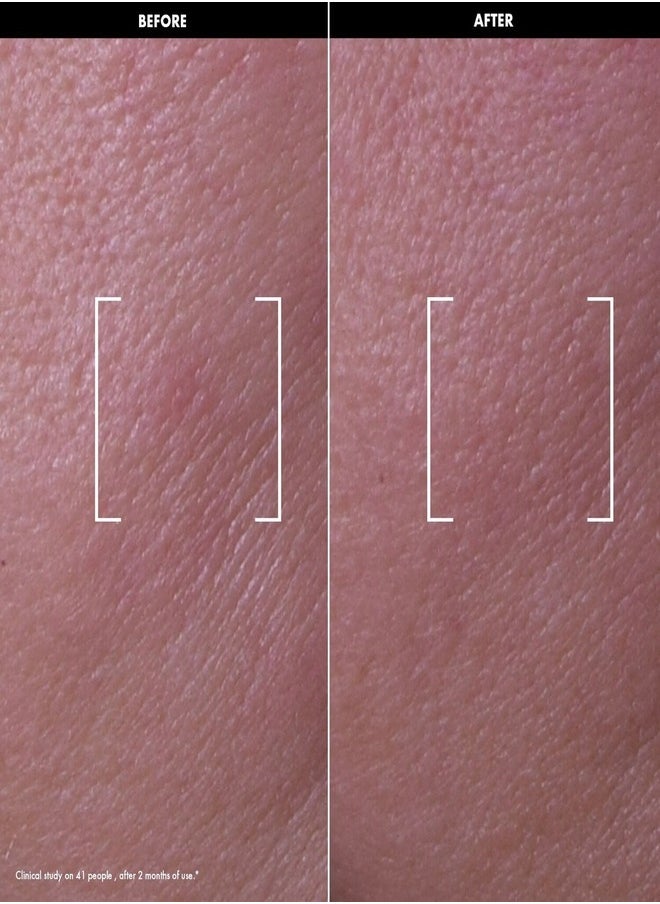 SEPHORA - SEPHORA COLLECTION Lift & Firm Recovery Firming Night Oil with Retinol – 30ml - Image 1