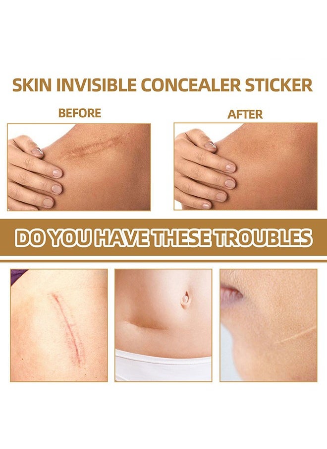 Jaysuing - 60PCS Tattoo Cover Up,Scar Cover Stickers Tape,Waterproof Ultra Thin Patch Pads Concealer Body Leg Bruise Stretch Scar Dark Spots Vitiligo Skin Makeup,Long Lasting Invisible Tattoo Flaw Conceal Patch - Image 1