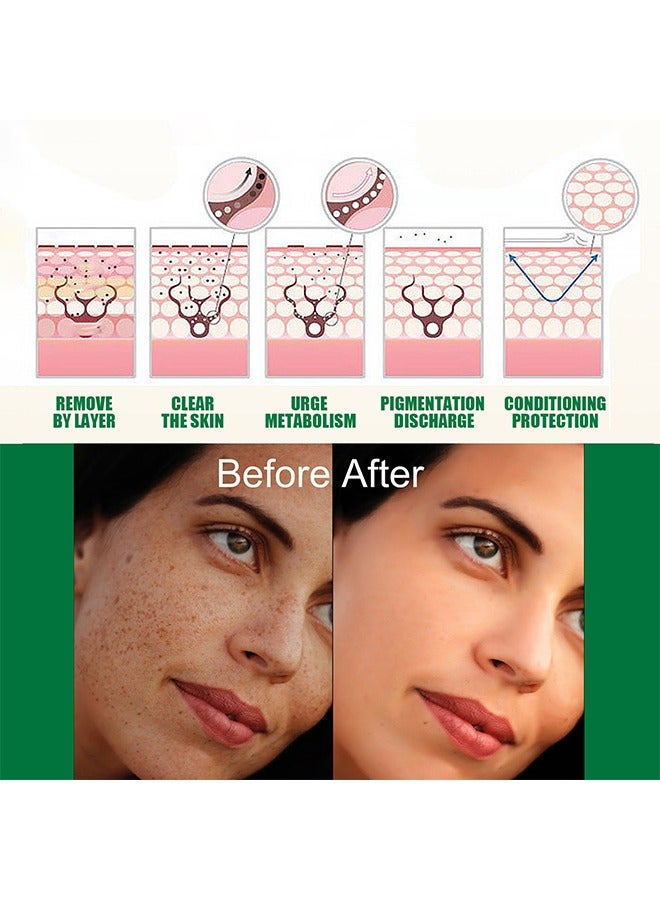 EELHOE Dark Spot Correcting Glow Serum, Moisturizing Whitening Brightening Serum, Dark Spot Treatment, Repair Dullness, for Acne Scars, Fine Lines, Hyperpigmentation and Dark Circles 50ml - Image 5