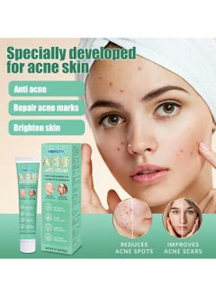 HBESTY Acne Treatment Face Cream，Oil Control Anti Acne Facial Care ，Acne Spot ，Cystic Acne，Fungal Acne ，Face Acne Spot Treatment and Acne Scar Treatment  Post Acne Marks Treatment，Pimple Remover， Acne Repair  - Image 1
