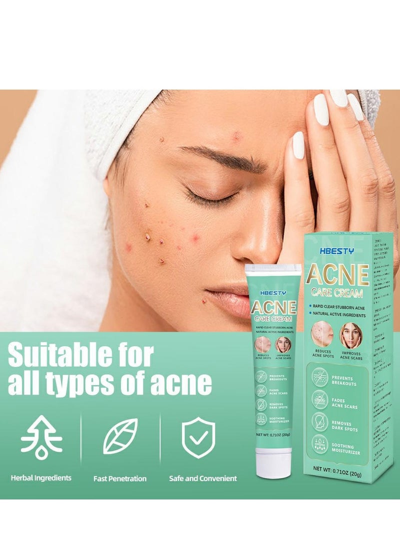 HBESTY Acne Treatment Face Cream，Oil Control Anti Acne Facial Care ，Acne Spot ，Cystic Acne，Fungal Acne ，Face Acne Spot Treatment and Acne Scar Treatment  Post Acne Marks Treatment，Pimple Remover， Acne Repair  - Image 3