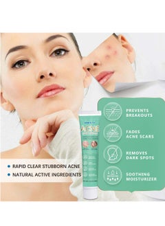 HBESTY Acne Treatment Face Cream，Oil Control Anti Acne Facial Care ，Acne Spot ，Cystic Acne，Fungal Acne ，Face Acne Spot Treatment and Acne Scar Treatment  Post Acne Marks Treatment，Pimple Remover， Acne Repair  - Image 4