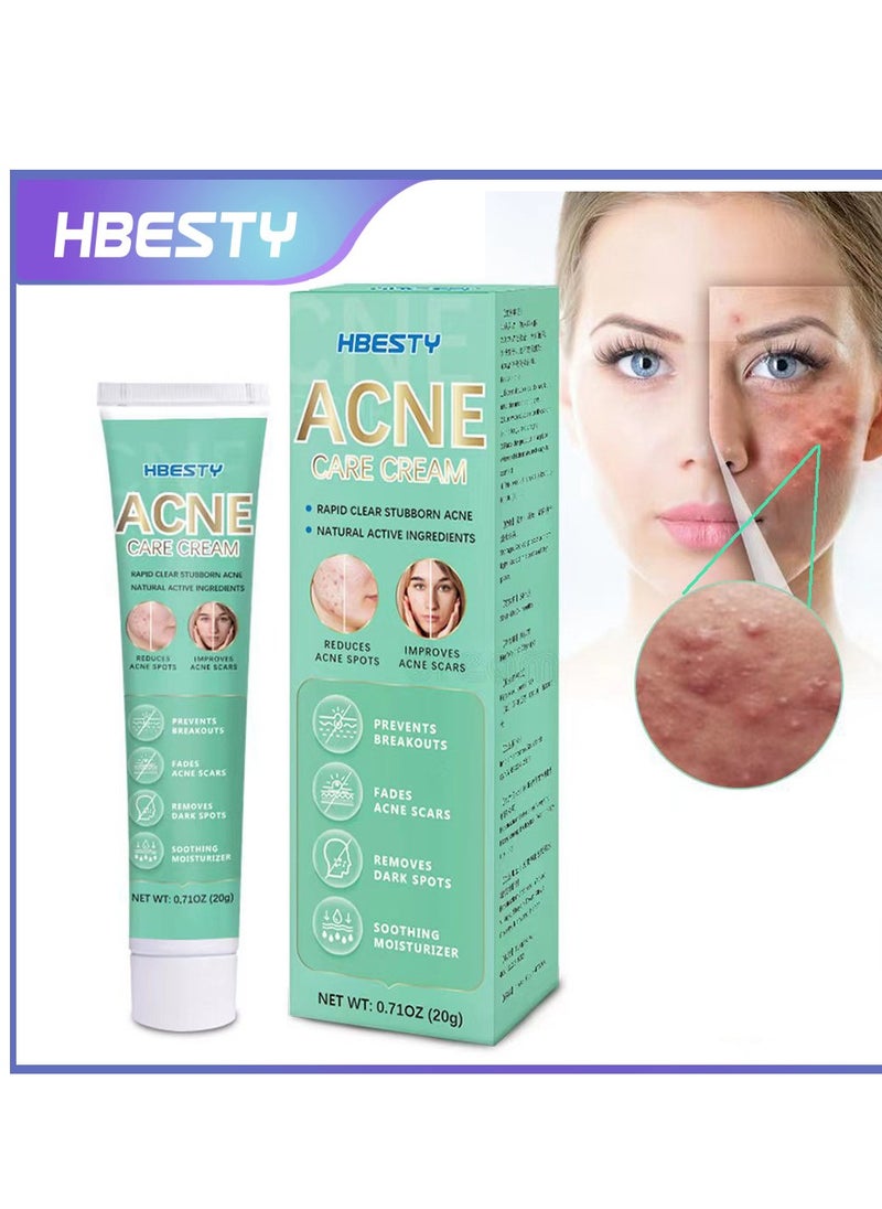 HBESTY Acne Treatment Face Cream，Oil Control Anti Acne Facial Care ，Acne Spot ，Cystic Acne，Fungal Acne ，Face Acne Spot Treatment and Acne Scar Treatment  Post Acne Marks Treatment，Pimple Remover， Acne Repair  - Image 5
