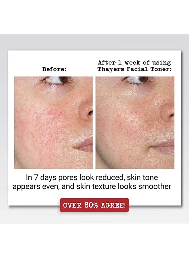 THAYERS Alcoholfree Hydktr Rose Petal Witch Hazel With Aloe Vera Clear 12 Fl Oz (Pack Of 2) - Image 3