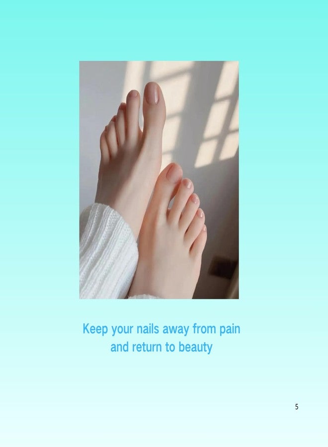 مجموعة SunOutDeeal لعلاج الأظافر الغائرة مع رقعة تصحيح منحنية، طقم إزالة أظافر مطور، أدوات للعناية بالقدمين في المنزل - Image 5