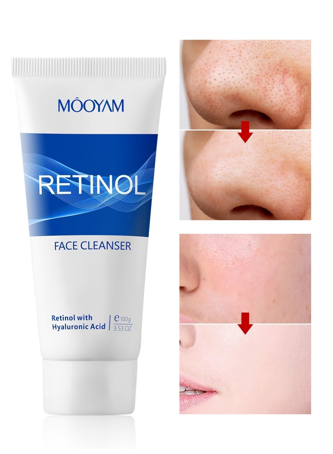 Retinol Face Cleanser Facial Cleanser with Hyaluronic Acid for Anti-Aging and Fine Lines, Improve Skin’s Texture & Moisturizes for Cleaner, Softer Face 100g