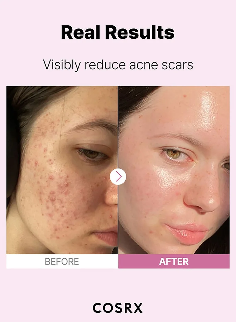 COSRX The Niacinamide 15 Skin Serum