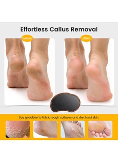 BEZOX Glass Foot Scrubber(1 Pcs) - Nano-Glass Pedi Egg Pumice Stone For Feet Dead Skin, Plastic-Free Pedicure Foot File Callus Remover For Silky Smooth Feet - Walnut Wood Handled  - Image 3