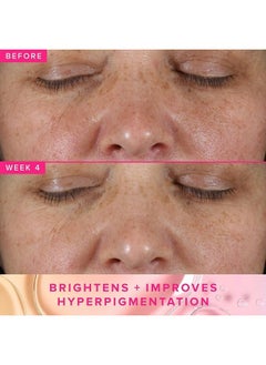 FARMACY 3% Txa Brightening Toner For Face Powerful Dark Spot Corrector & Face Toner With Azelaic Acid & Pha 120Ml  - Image 4