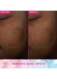 FARMACY 3% Txa Brightening Toner For Face Powerful Dark Spot Corrector & Face Toner With Azelaic Acid & Pha 120Ml  - Image 5