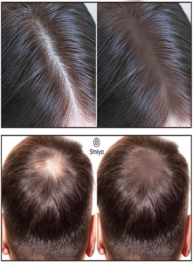 SIMIYA Instant Natural Hairline Colour Touch-Up Powder for Women & Men - Black | Hair Shading Sponge Pen, Hairline Shadow Powder Stick, Quick Hair Root Touch-Up Stick (BROWN, PACK OF 1) - Image 4