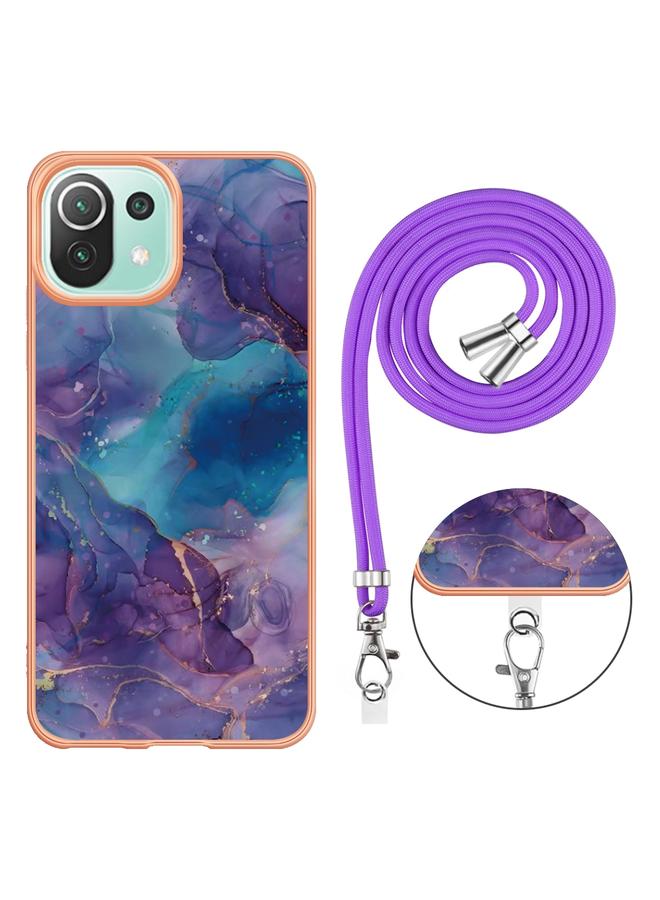 erorex Case For Xiaomi 11 Lite Electroplating Marble Dual-side IMD Phone Case with Lanyard - Image 2