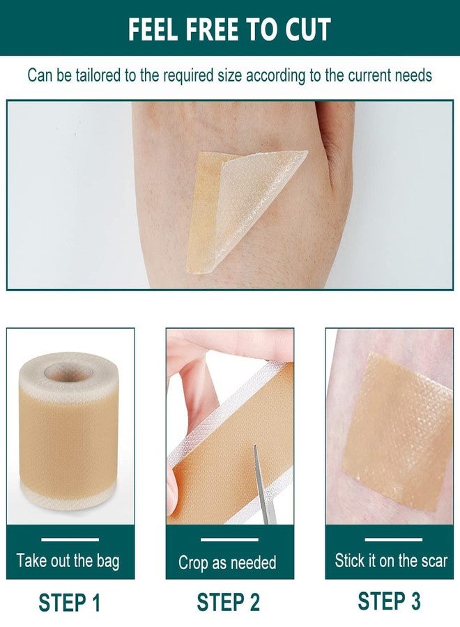 CLOSAL® 1 Roll Silicone Scar Sheets Waterproof Cica Care Gel Sheets Wound Repair Desalination Strip Scar Removal Sticker for Surgery Injury Burns Scars - Image 5