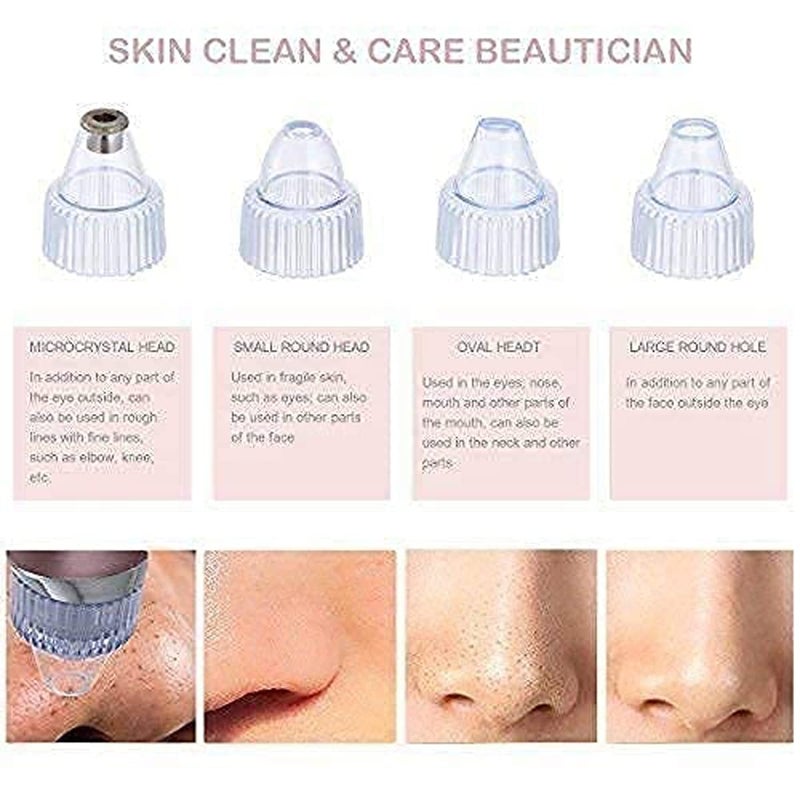 Avenn Avenn 4 in 1 Multifunction Whitehead Blackhead Remover Tool Electric Derma suction Machine Acne Pimple Pore Cleaner Vacuum Tools Facial Cleanser Device for Face Nose Skin Care - Image 5