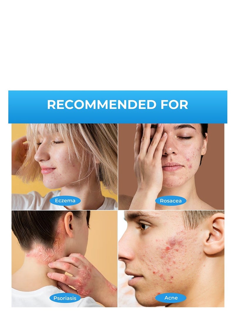 Sumifun Extra Strength Calamine Psoriasis Ointment, Promote Skin Health Relieve Psoriasis, Eczema and Urticaria Relieve Skin Itching & Inflammation 20g - Image 2