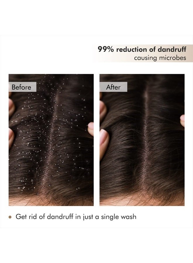 mCaffeine Scalp Scrub for Dandruff Treatment | Coffee, Natural AHA & Rosemary | Scalp Exfoliator Scrub for Itchy Scalp | SLS, Paraben & Mineral Oil Free | For All Hair & Scalp Types, 8.8 Oz - Image 3