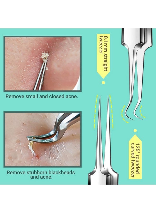 TsMADDTs Blackhead Remover Tools and Ingrown Hair Tweezers, 9PCS Pimple Popper Tool Kit, Ingrown Hair Removal Kit with Pimple Extractor, Pore Extractor, Tweezers, Razor - Image 3