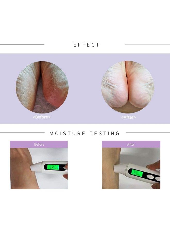 TOI:L Extra Silky Foot Mask Glove 5 Pairs Premium Foot Care Treatment Intensive Moisturizing Nourishing Repairing For The Dry & Rough Damaged Foot (Guerande Salt+Sweet Almond Oil)  - Image 5
