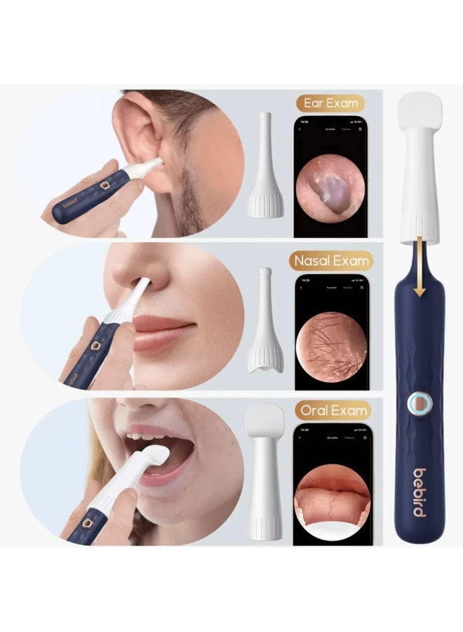 Bebird EarSight Plus Smart Visual Ear Cleaner Flexi-Otoscope - Image 5
