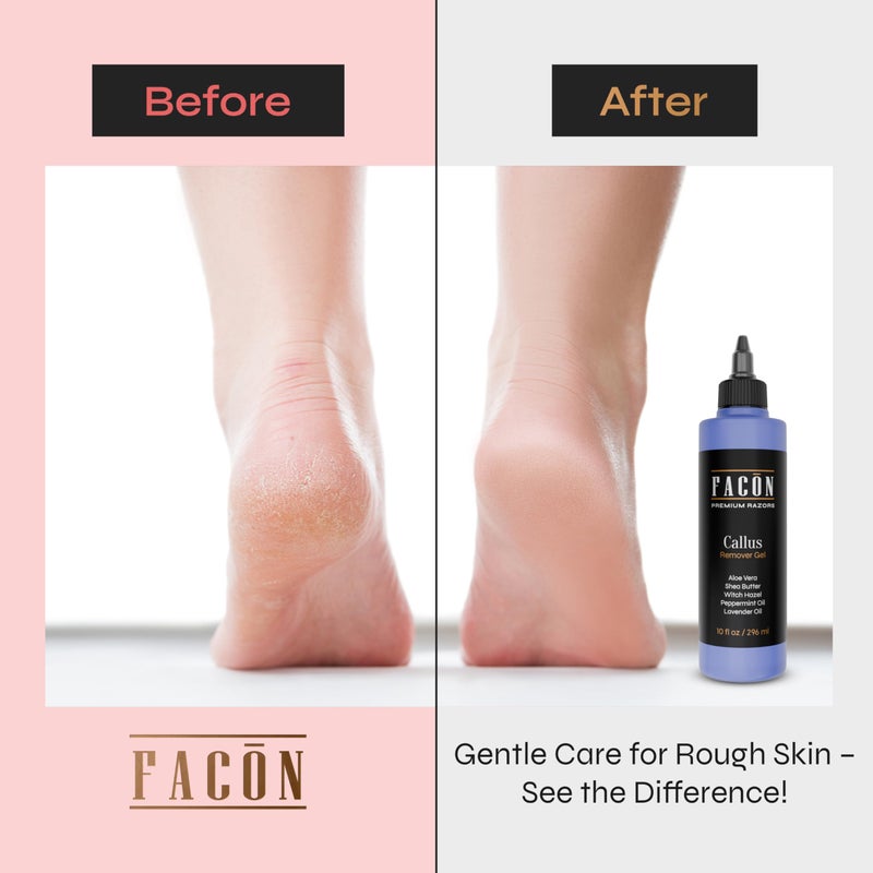 FACON جل مزيل الجلد الميت الاحترافي من فاسون للقدمين مع الألوة فيرا وزبدة الشيا والنعناع وبلسم الساحرة، معطر باللافندر، مرطب للجلد الميت، سبا للقدمين في المنزل، يزيل الجلد الجاف المتشقق والميت، 10 أونصة سائلة - Image 3
