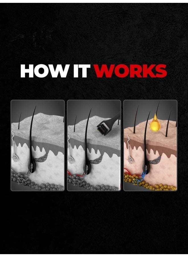 BEARDO Beard Activator Beard Roller, 540-0.5mm Chromium needles, Stimulates Hair Growth - Follicles activation - Image 4