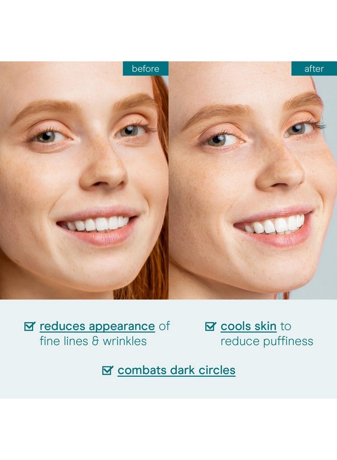 Baebody جل العيون جل تبريد العيون لعلاج الهالات السوداء والانتفاخات كريم ترطيب العيون جل العيون المهدئ جل العيون المشرق جل العيون النهاري والليلي - Image 5