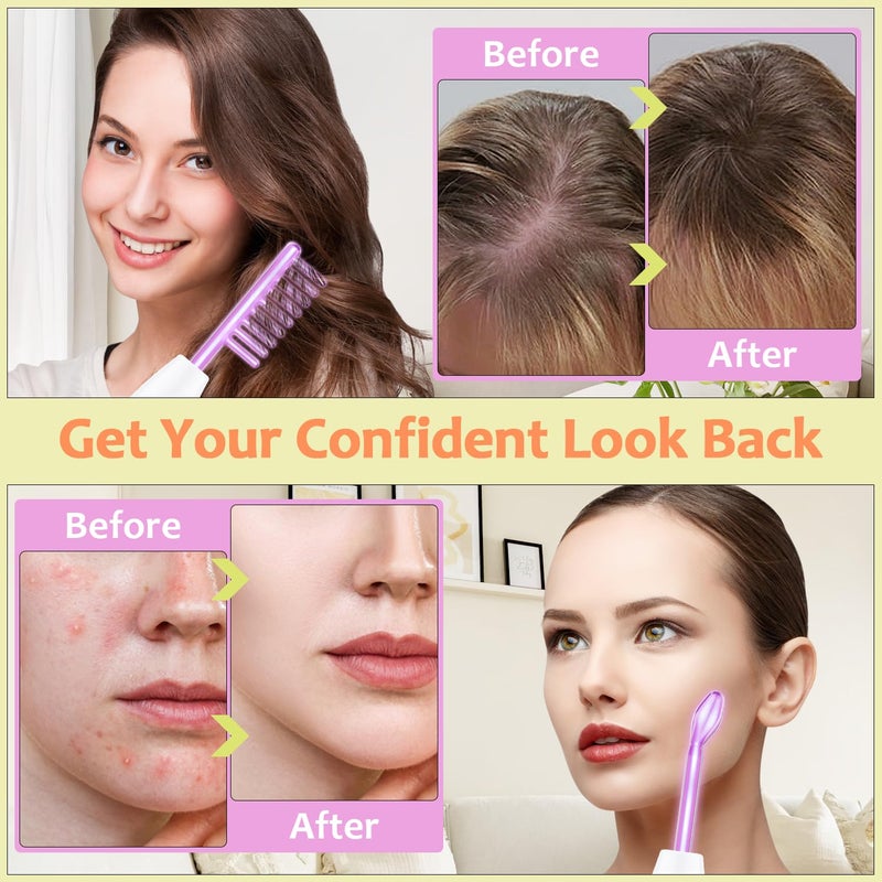 Uaike High Frequency Facial Wand - Uaike 4 in 1 Violet Portable Handheld High Frequency Facial Machine - at Home Face Skin Wand Device with 4 Pcs Purple Glass Tubes - Image 5