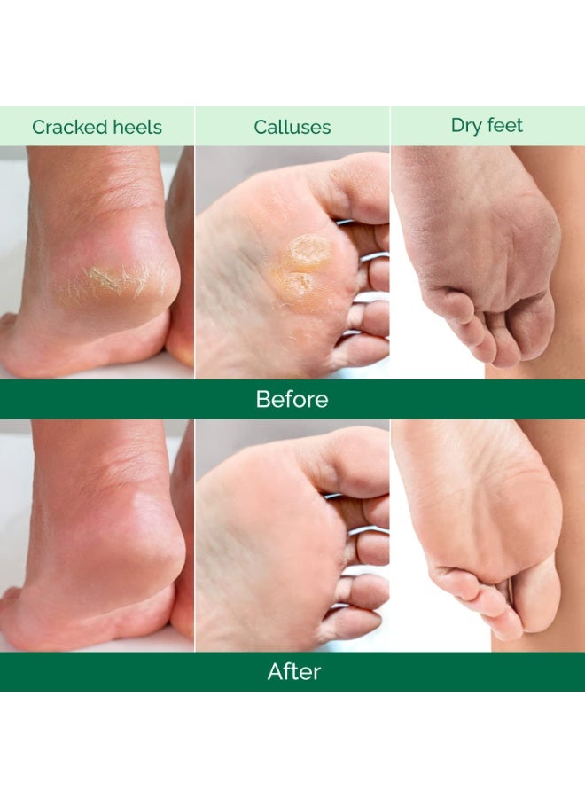 Plantifique PLANTIFIQUE Foot Peeling Mask 2 Pack for Men | Dermatologically Tested Repairs Heels & Removes Dry Dead Skin for Baby Soft Feet | Exfoliating Foot Peel Mask for Dry Cracked Feet | Aloe Vera  - Image 2