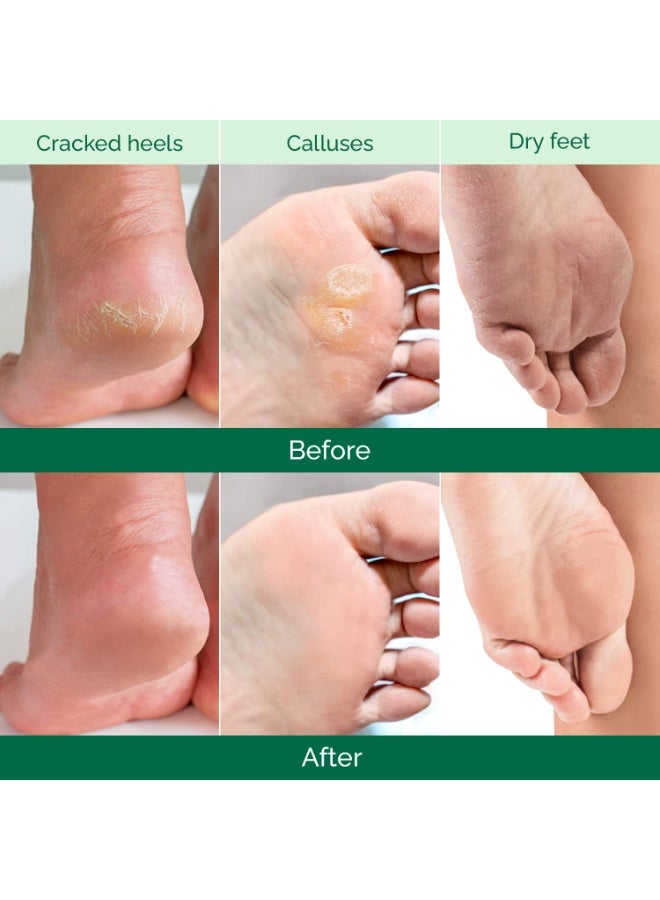 PLANTIFIQUE Foot Peeling Mask 2 Pack for Men | Dermatologically Tested Repairs Heels & Removes Dry Dead Skin for Baby Soft Feet | Exfoliating Foot Peel Mask for Dry Cracked Feet | Aloe Vera - Image 5