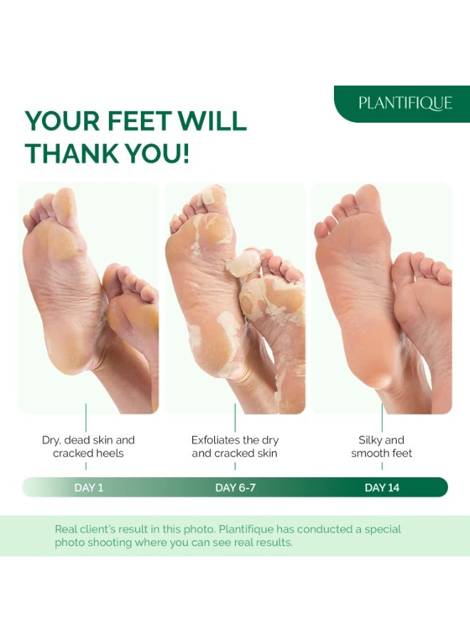 PLANTIFIQUE Foot Peeling Mask 2 Pack for Men | Dermatologically Tested Repairs Heels & Removes Dry Dead Skin for Baby Soft Feet | Exfoliating Foot Peel Mask for Dry Cracked Feet | Aloe Vera - Image 2