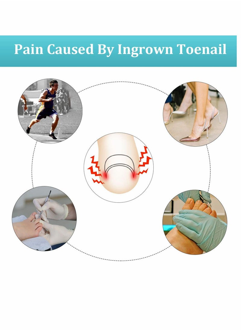 Ingrown Toenail Tool Set, Including Ingrown Toenail File and Lifter, 60 Pieces Elastic Patch Curved Toenails Brace Stickers, 60 Pieces Ingrown Toenail Correction Stickers (122 Pieces)