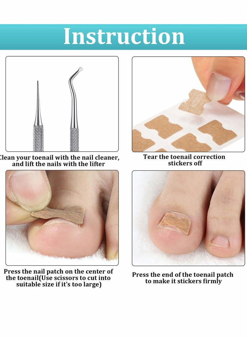 Ingrown Toenail Tool Set, Including Ingrown Toenail File and Lifter, 60 Pieces Elastic Patch Curved Toenails Brace Stickers, 60 Pieces Ingrown Toenail Correction Stickers (122 Pieces)