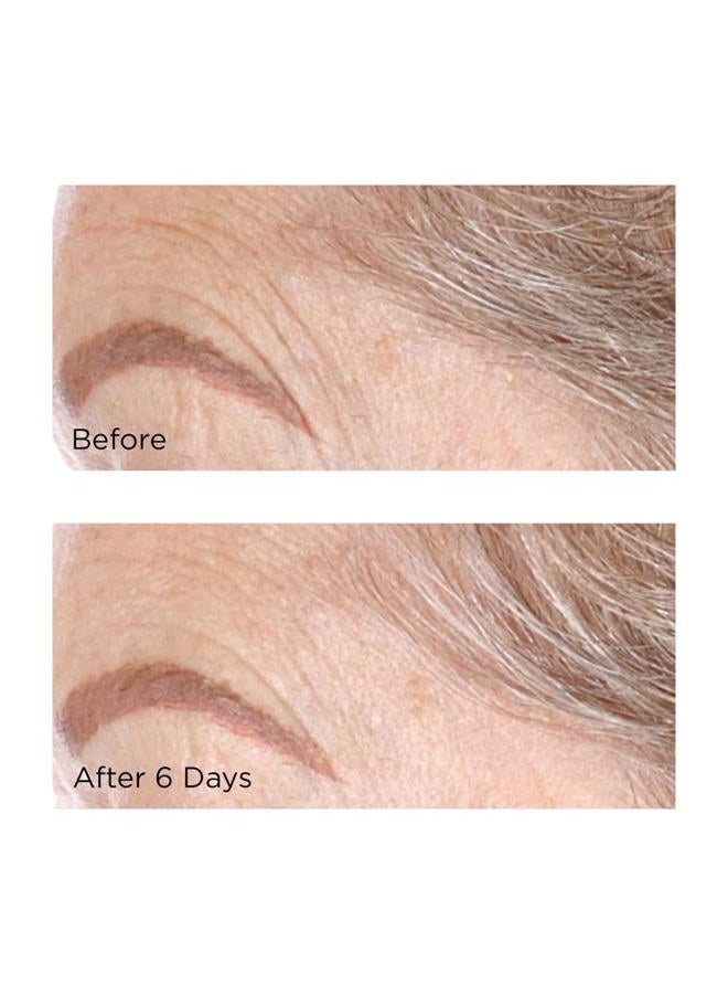 Perricone MD Cold Plasma Plus+ Concentrated Treatment Sheet Mask, 6 ct. - Image 4