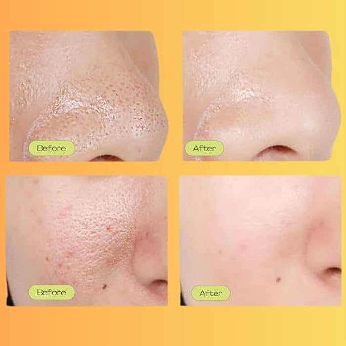 Luelle Pore Minimizer, Facial Essence for Minimizing the Appearance of Pores, Pore Minimizer Serum for Face, Even Skin Tone, Relieving Dryness, Oil Control Firming - Image 3