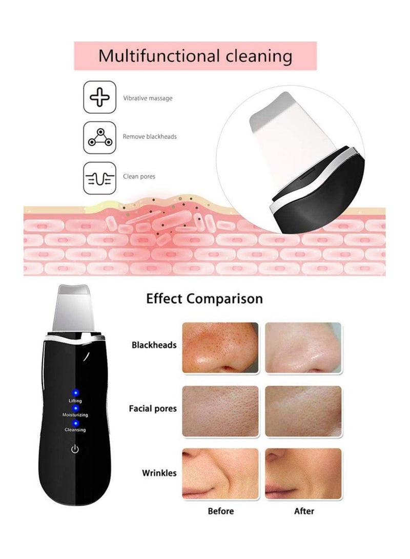 Generic Ultrasonic Skin Facial Scrubber Face Spatula, Professional Deep Cleaning Skin Dirt Blackhead Remover Reduce Wrinkles and Spot Facial Lifting Peeling Skin Care Beauty Device Tool (Black)  - Image 4