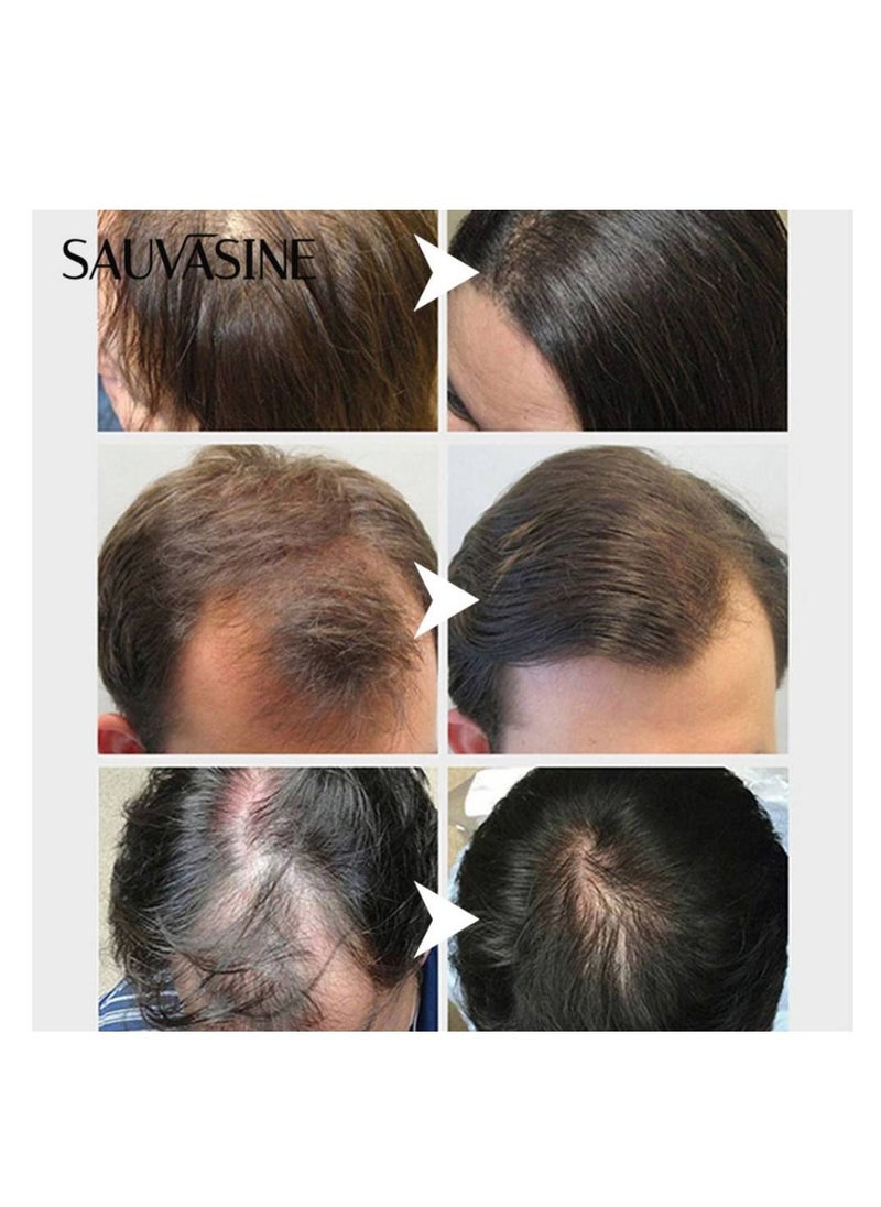 SAUVASINE - Onion Hair Growth Oil with Natural Ingredients , 100% Virgin , Cold Pressed - Pure - Natural Oil with No harmful Chemical Added , Scalp Treatment , 100ml - Image 1