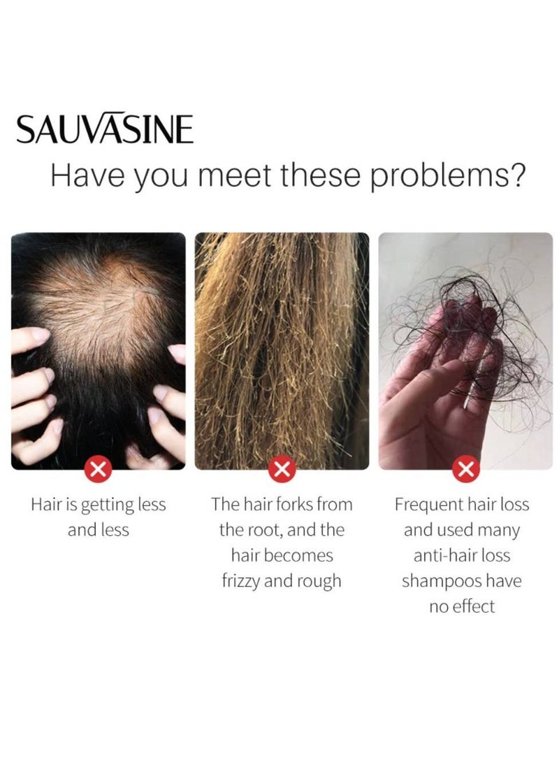 SAUVASINE - Onion Hair Growth Oil with Natural Ingredients , 100% Virgin , Cold Pressed - Pure - Natural Oil with No harmful Chemical Added , Scalp Treatment , 100ml - Image 1