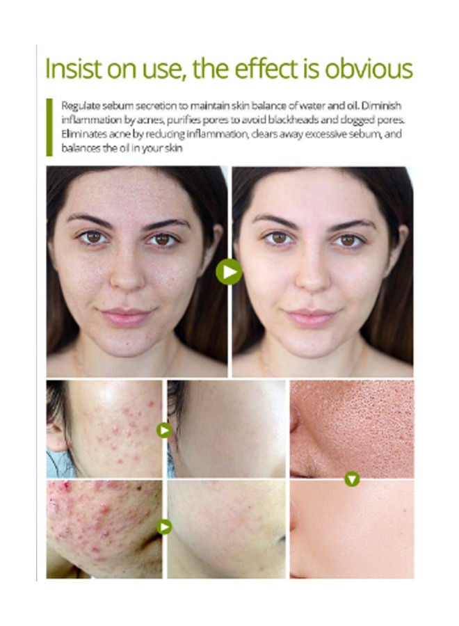 فايبرنت جلامور كريم علاج حب الشباب بالأعشاب 30 جرام - Image 4