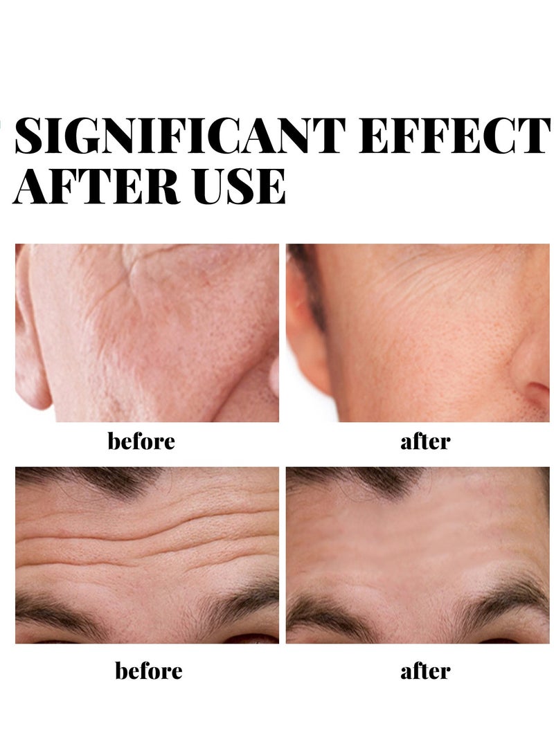 إيلهو كريم كولاجين للرجال، جل مرطب للتجاعيد ومضاد للشيخوخة للرجال، لوشن لشد البشرة وشد الوجه (CC1) - Image 3