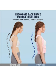 GUDOO Back Brace and Posture Corrector for Women and Men Back Straightener Posture Corrector Scoliosis and Hunchback Correction Back Pain Spine Corrector Support Adjustable Posture Trainer Pink  S  - Image 5