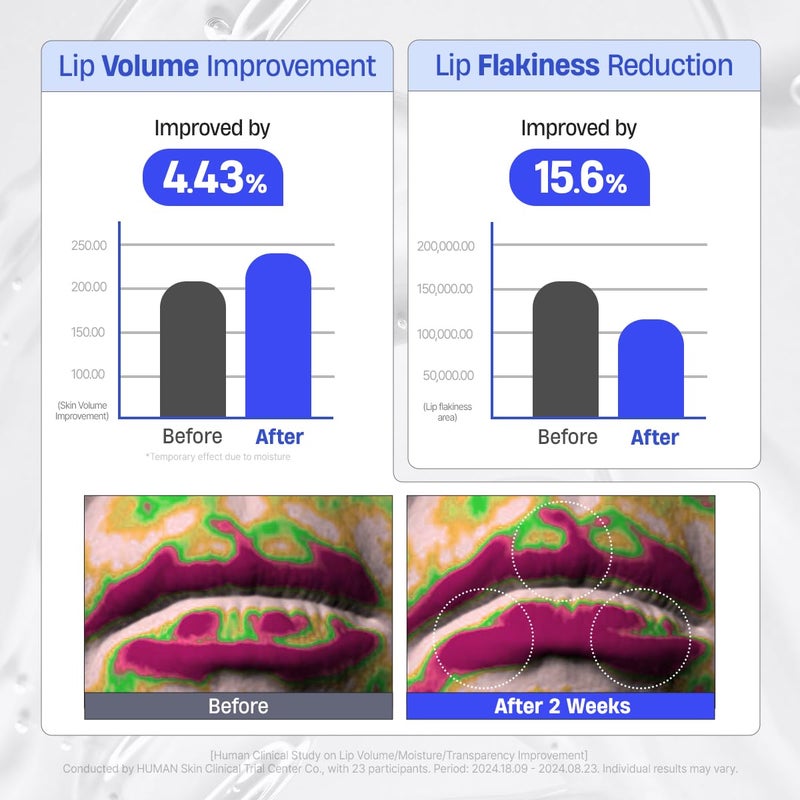 DERMATORY Hyalluron Peptide Volume Lip Mask Balm - Hydrating & Moisturizing Lip Mask for Day & Night Care (10ml) - Image 4