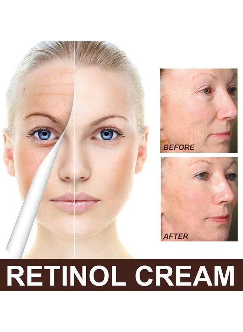 EELHOE كريم إزالة التجاعيد المضاد للشيخوخة مع الريتينول، كريم الريتينول EELHOE المضاد للشيخوخة مع حمض الهيالورونيك والفيتامينات - Image 4