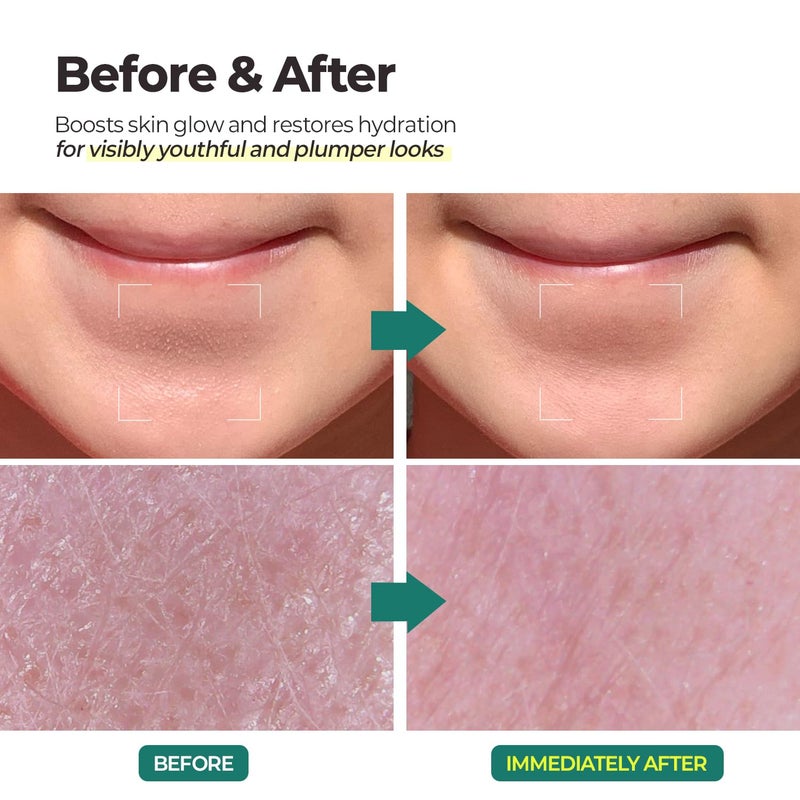 MOTHER MADE جل تقشير أكوا الأخضر من ماذر ميد ل.هـ.أ، مقشر عميق للمسام للوجه، مقشر لطيف للوجه، مزيل للجلد الميت، سليلوز طبيعي للتقشير، نباتي، عناية بالبشرة الكورية (100 مل / 3.38 أونصة سائلة) - Image 4