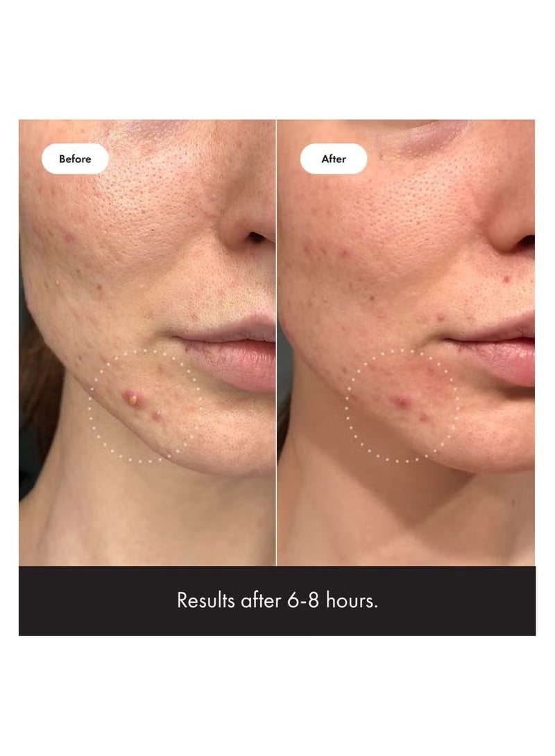 مايتي باتش مستحضرات التجميل البطل العظيمة ، غير مرئي+، 39 بقع - Image 4