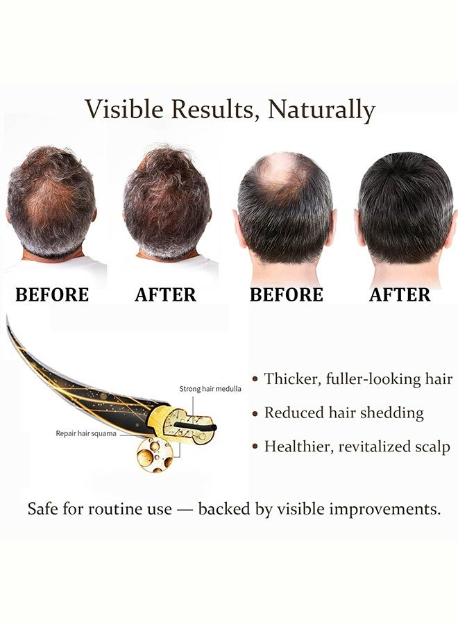 HOEGOA Thickening Hair Care Essence, Hair Regrowth System, Alphainfuse Hair Regrowth System, Advanced Hair Growth Treatment Serum For Thicker, Fuller Hairs, Strengthens Roots, Gentle Painless, Supports Healthy Hairs Growth For Men & Women - Image 4