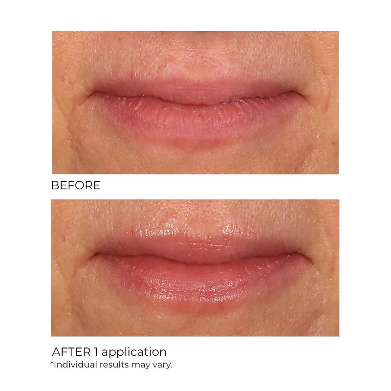 nassif md NassifMD Vanilla Lip Sugar Scrub, Moisturizer and Exfoliator, Vanilla Lip Scrub, Exfoliating Lip Scrub with Jojoba Oil, 0.50 oz - Image 3