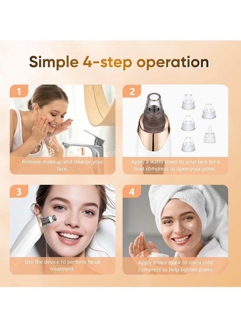 Generic Blackhead Remover Vacuum - Blackhead Extractor Tool for Face, Blackhead Remover for Face with 3 Adjustable Suction Levels, 5 Probes, USB Chargeable Pore Cleaner (White)  - Image 4