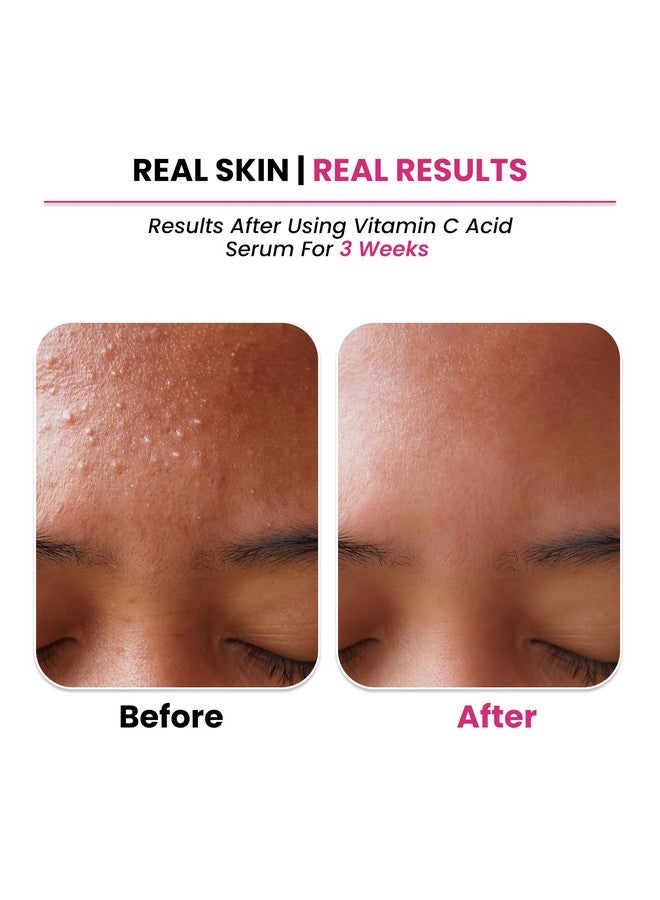 ThriveCo Vitamin C Face Serum with 33kDa + 5kDa Hyaluronic Acid | Skin Brightening Serum for Glowing Skin | Best Vitamin C Serum for Dark Spots, Hydration & Anti-Aging | 30ml - Image 5