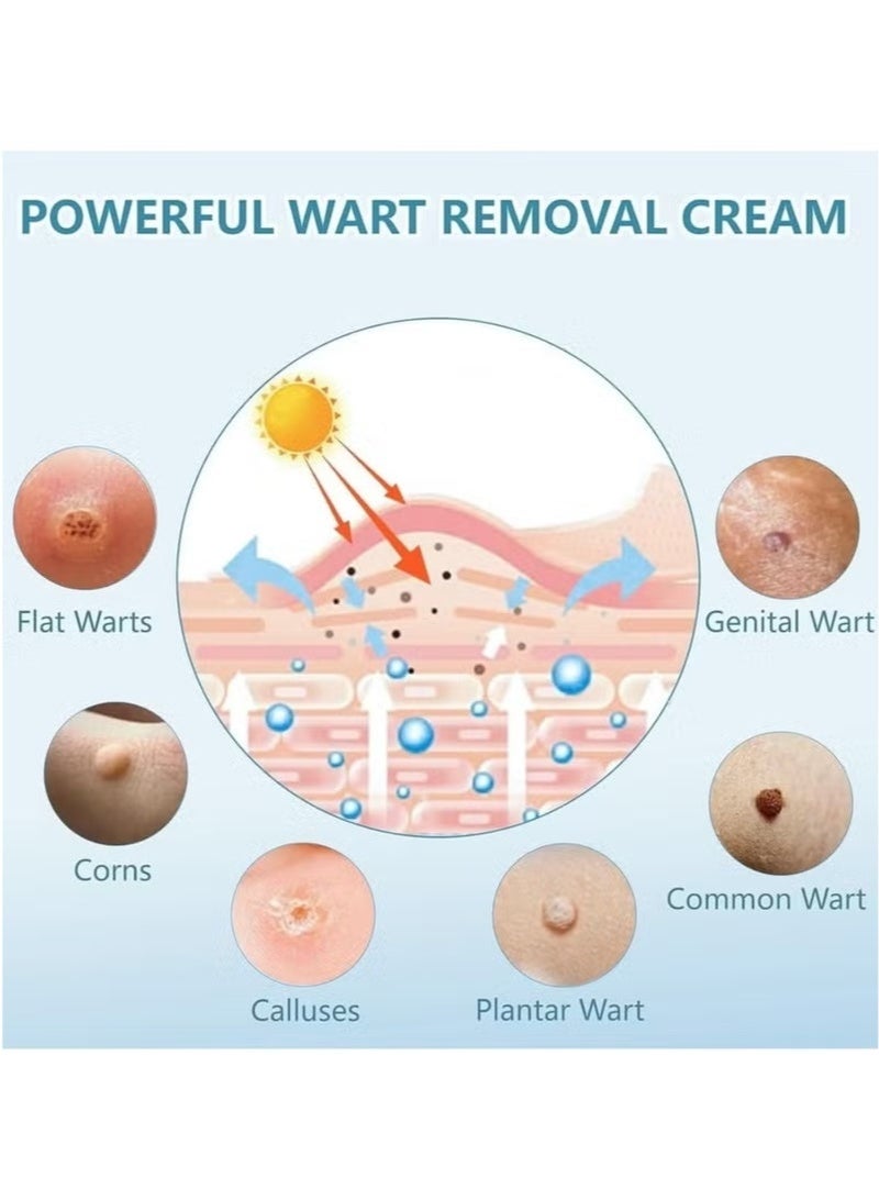 ساوث مون مرهم الثآليل مع حمض الساليسيليك، مزيل الثآليل المُجمد، مرهم مزيل الثآليل، مُجمد سريع المفعول، مزيل الثآليل للثآليل التناسلية، الثآليل الأخمصية، الثآليل الشائعة، مسامير القدم، كريم الثآليل 20 جرام - Image 4