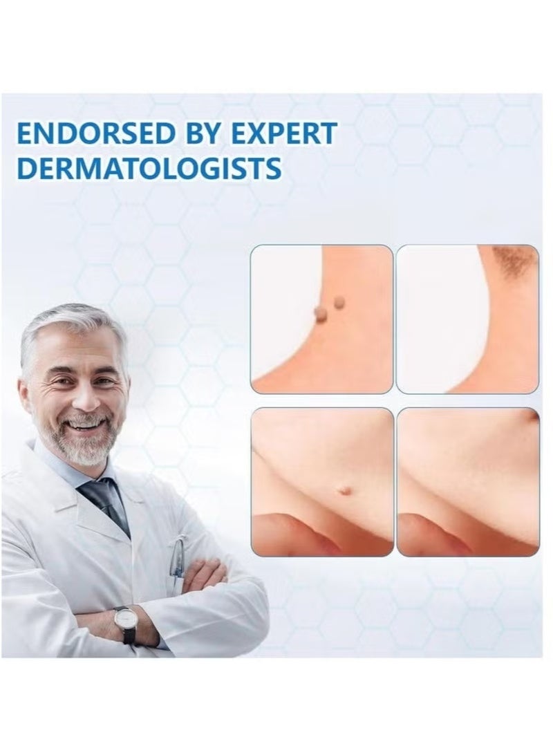 ساوث مون مرهم الثآليل مع حمض الساليسيليك، مزيل الثآليل المُجمد، مرهم مزيل الثآليل، مُجمد سريع المفعول، مزيل الثآليل للثآليل التناسلية، الثآليل الأخمصية، الثآليل الشائعة، مسامير القدم، كريم الثآليل 20 جرام - Image 3